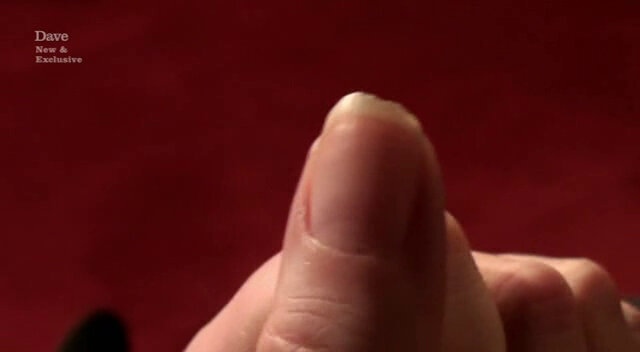 Image of Roisin Conaty’s bitten-down thumbnail.