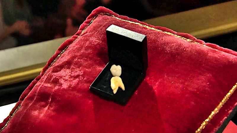 Image of the prize in this episode: what Mette Søndergaard describes as her “most expensive tooth”.